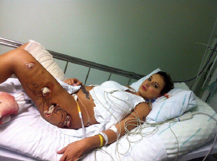 Андресса Урах после удаление имплантов