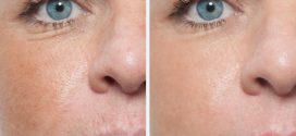 Як максимально швидко та ефективно омолодити шкіру обличчя? — Плюси біоревіталізації
